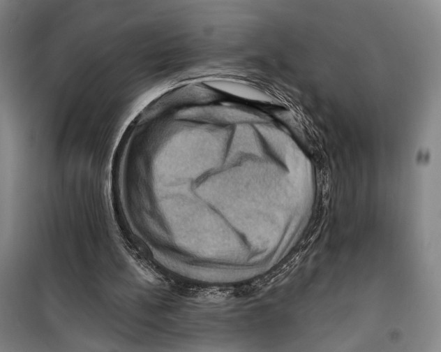 X0000099380148200806051129