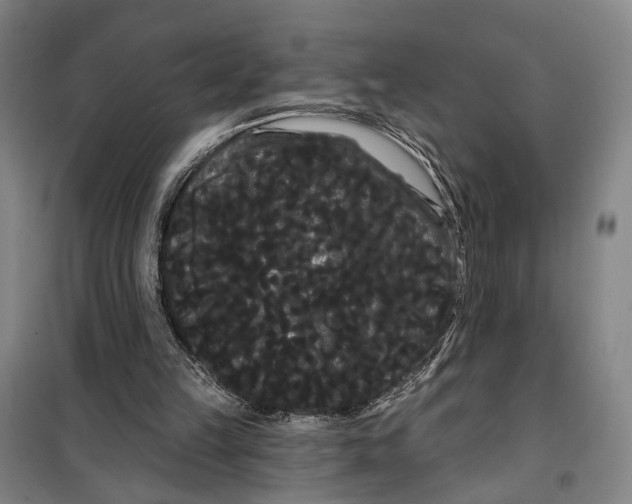 X0000099380149200806051129