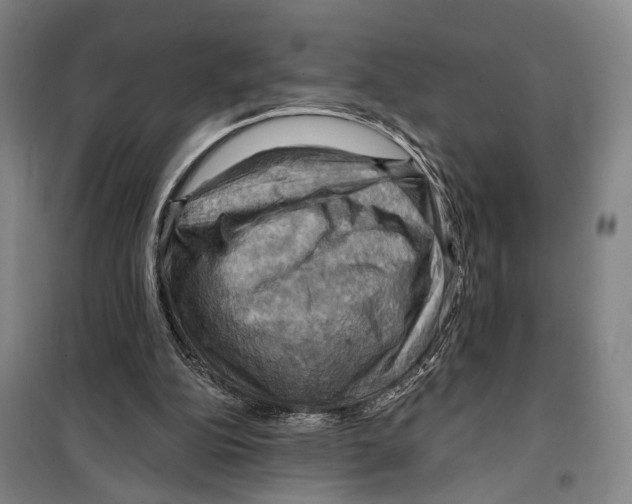 X0000099380152200806051129