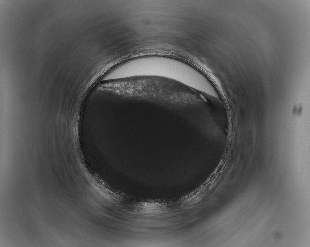 X0000099380154200806051129