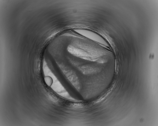 X0000099380157200806051129