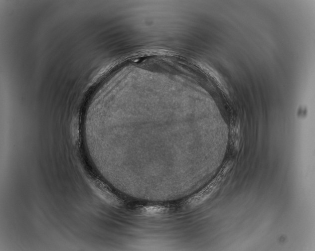 X0000099380158200806051129