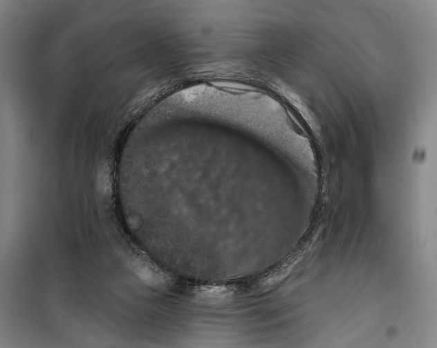 X0000099380161200806051129