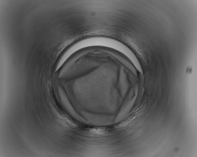 X0000099380164200806051129