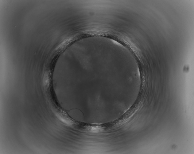 X0000099380165200806051129
