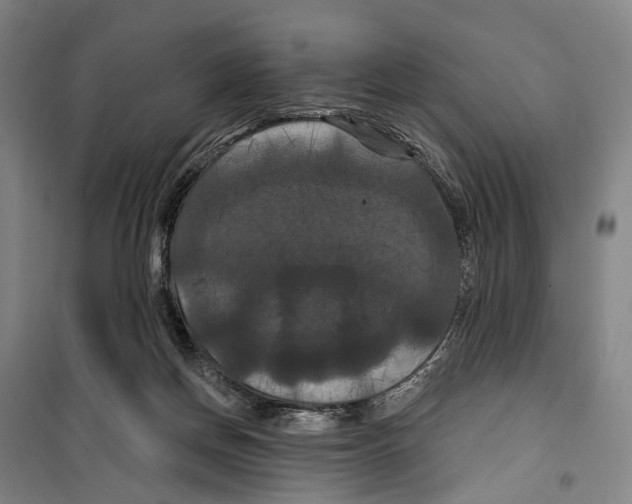X0000099380166200806051129