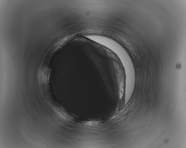 X0000099380168200806051129