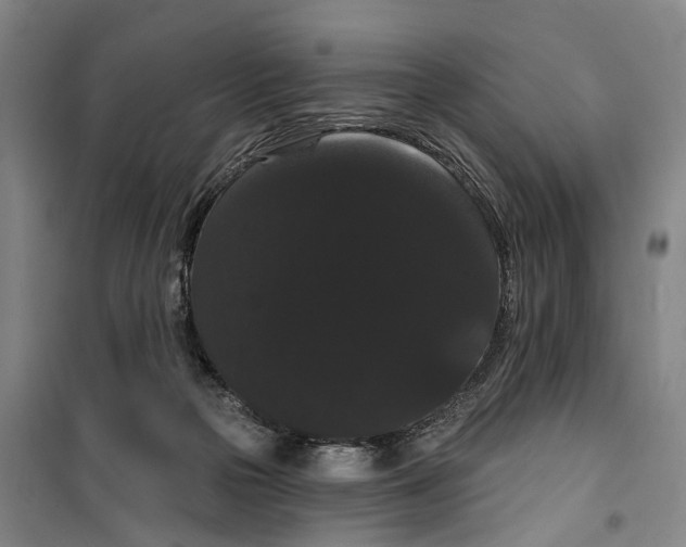 X0000099380169200806051129
