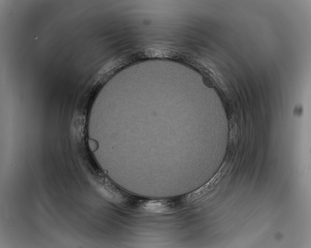 X0000099380171200806051129