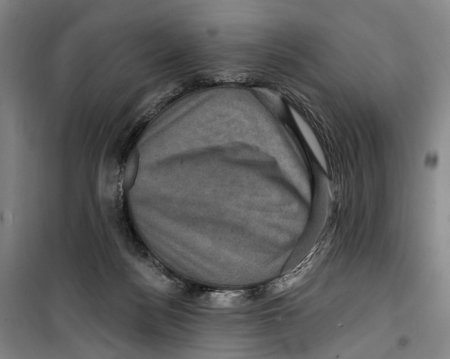X0000099380172200806051129