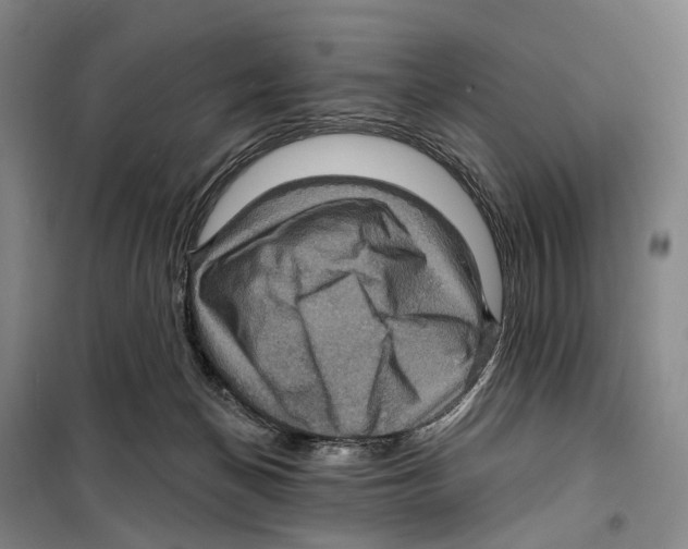 X0000099380174200806051129