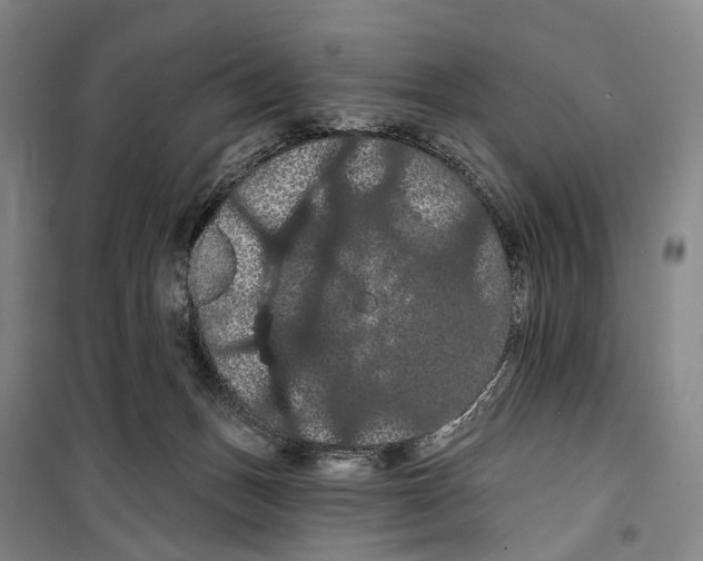 X0000099380175200806051129