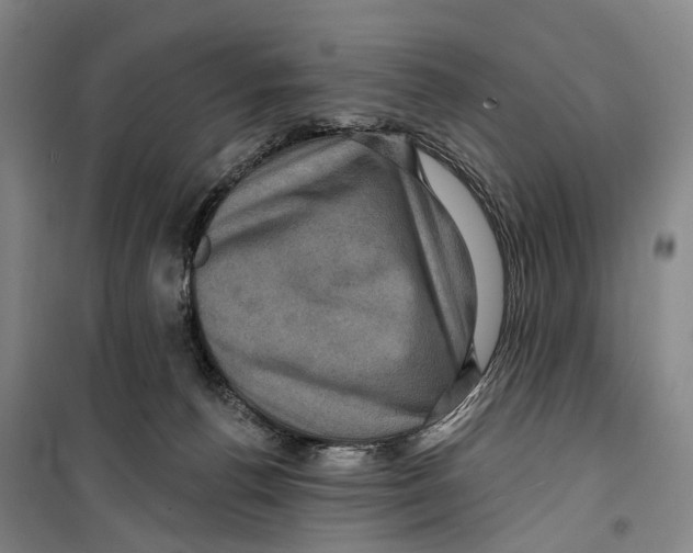 X0000099380176200806051129