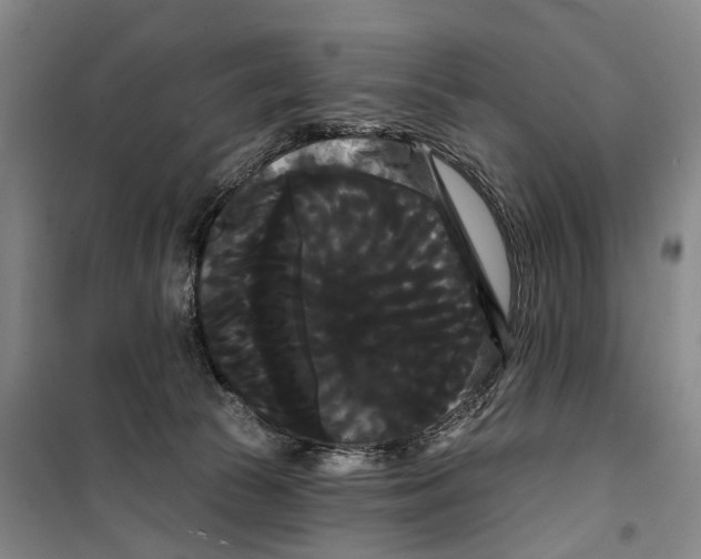 X0000099380177200806051129