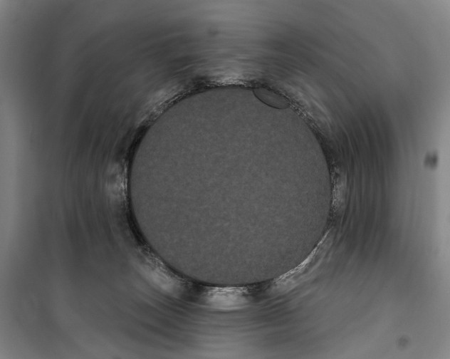 X0000099380179200806051129
