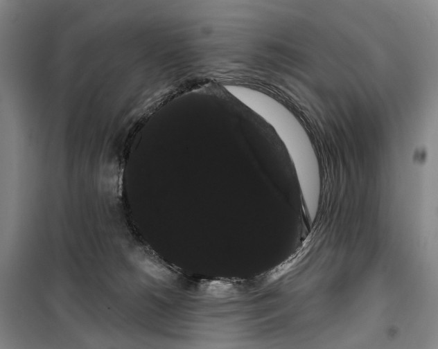 X0000099380180200806051129