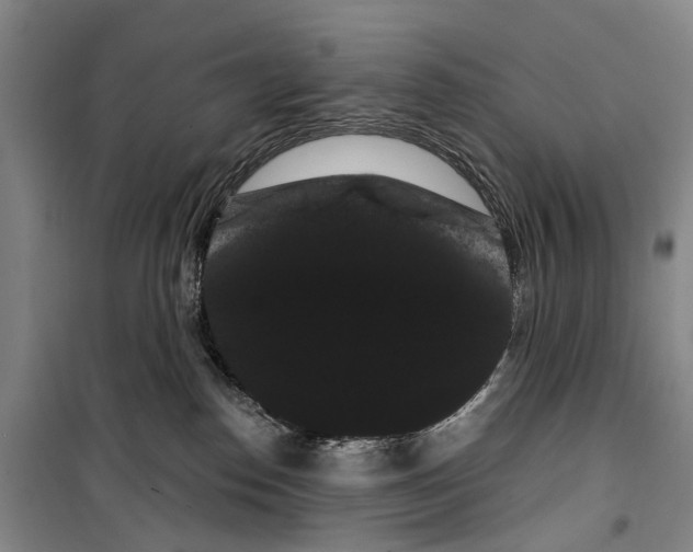 X0000099380186200806051129