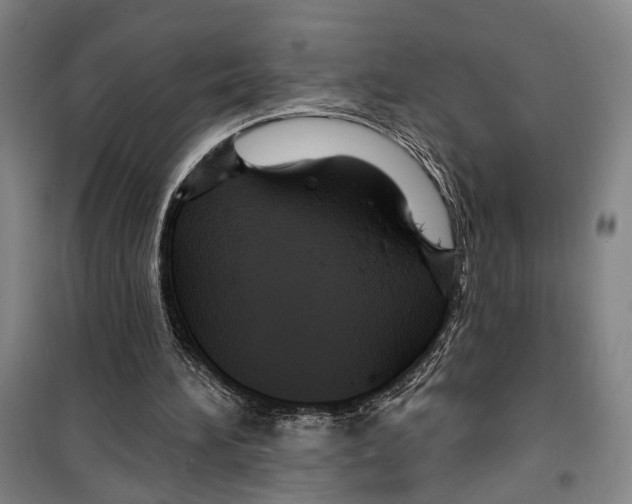 X0000099380196200806051129