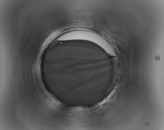 X0000099380197200806051129