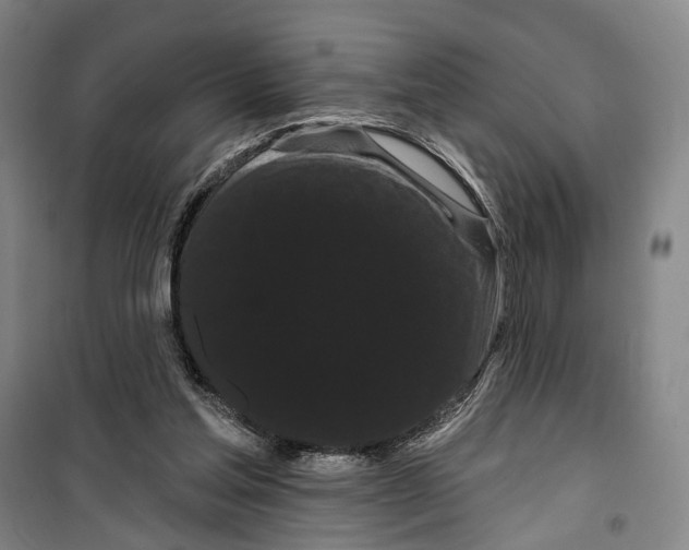 X0000099380205200806051129
