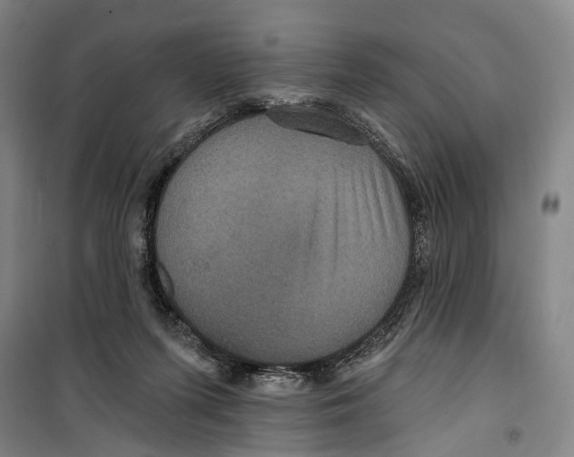 X0000099380215200806051128