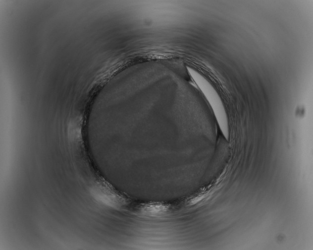 X0000099380217200806051128