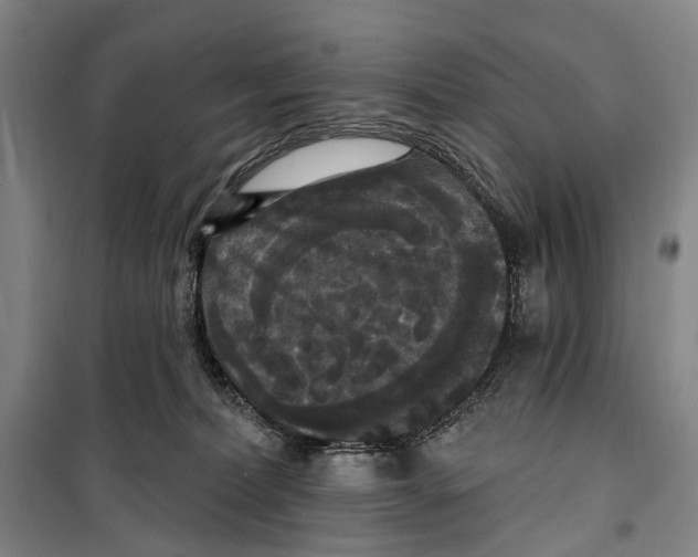X0000099380228200806051128