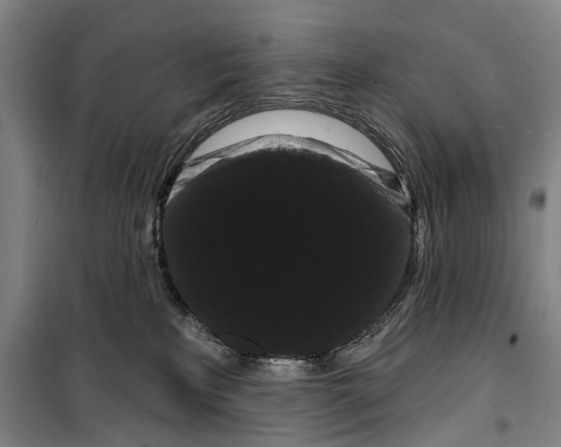 X0000099380233200806051128