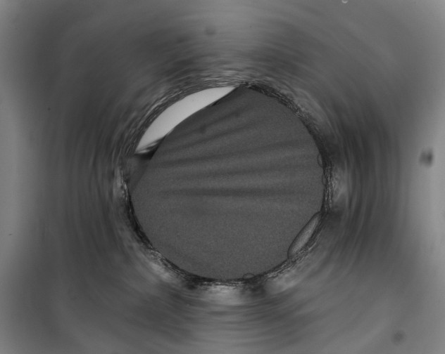 X0000099380236200806051128