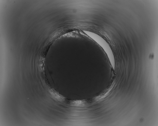 X0000099380237200806051128