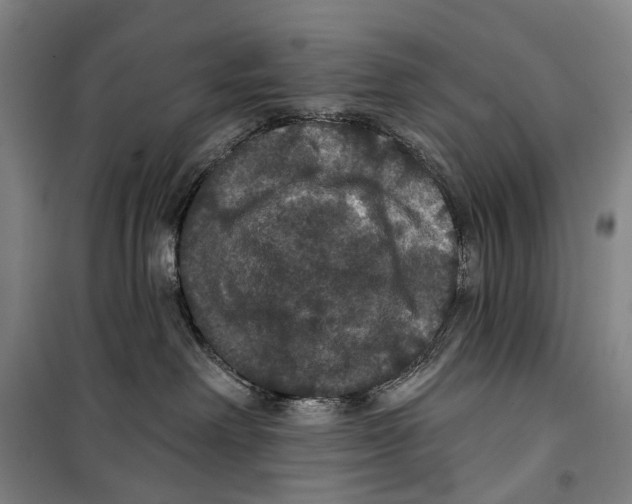 X0000099380238200806051128