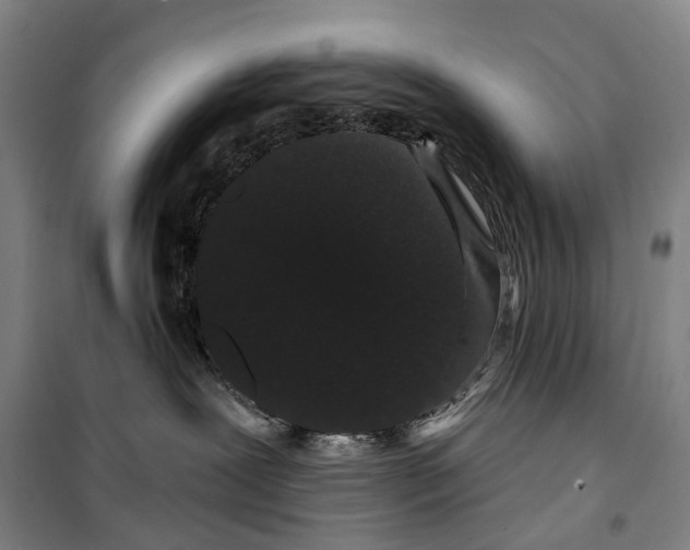 X0000099380239200806051128