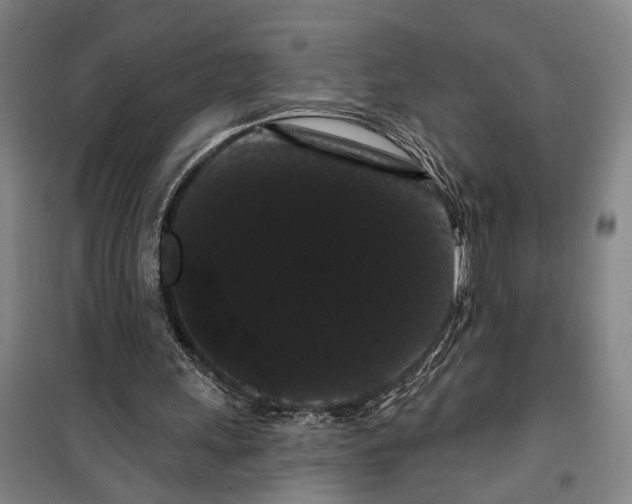 X0000099380243200806051127