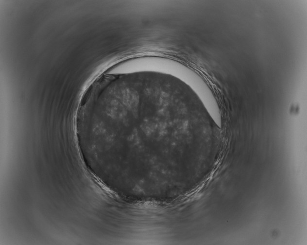X0000099380244200806051127