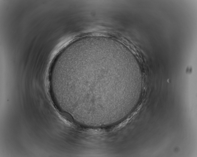 X0000099380245200806051127