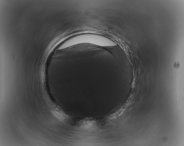 X0000099380247200806051127