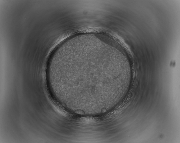 X0000099380250200806051128