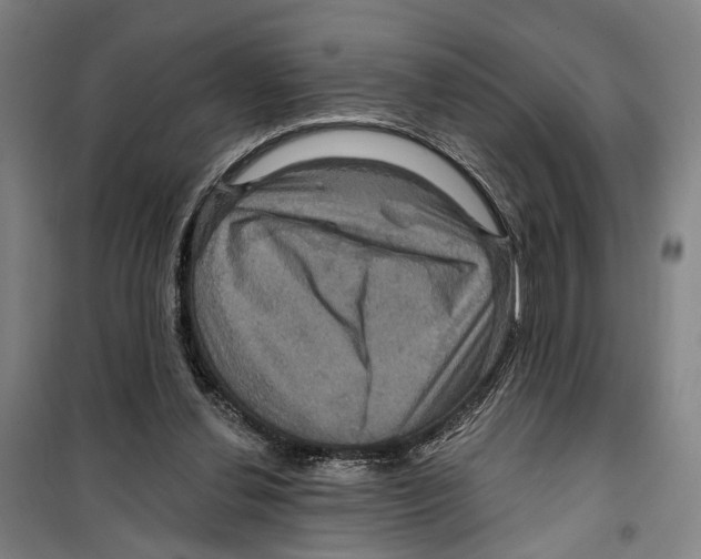 X0000099380252200806051128