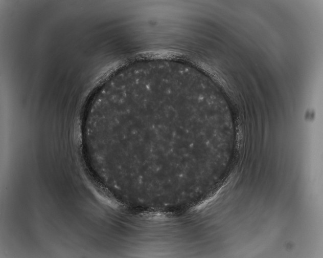 X0000099380254200806051128