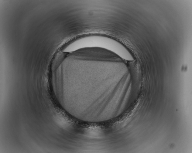 X0000099380256200806051128