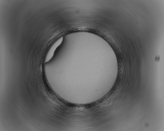 X0000099380262200806051128