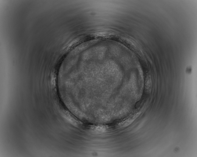 X0000099380282200806051128