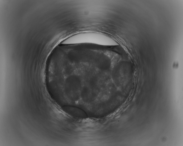 X0000099380290200806051127