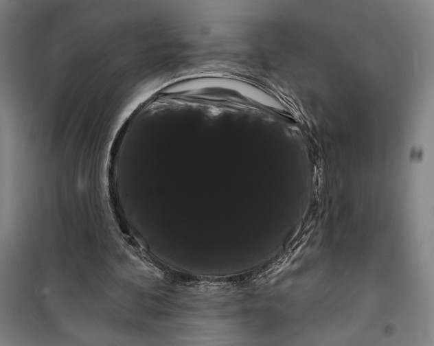 X0000099380292200806051127