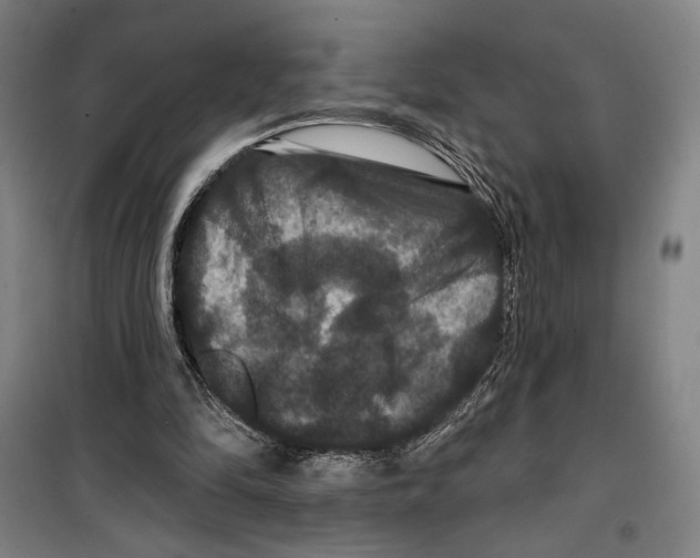 X0000099380294200806051127