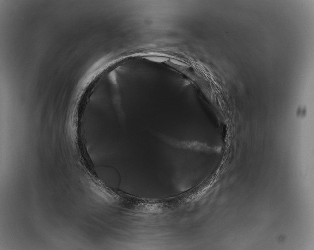 X0000099380295200806051127