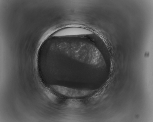 X0000099380296200806051127