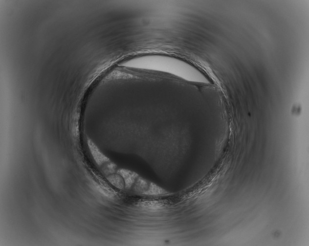 X0000099380299200806051127
