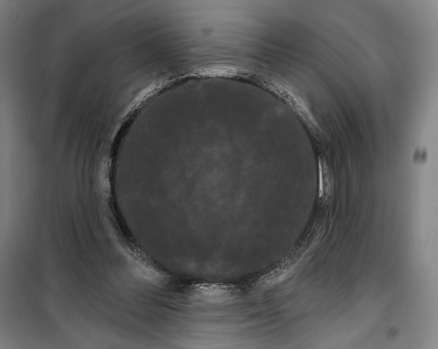 X0000099380300200806051127