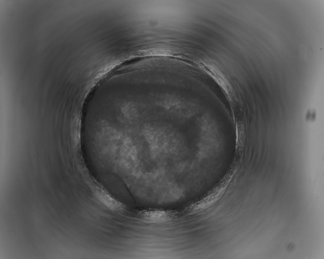 X0000099380301200806051127
